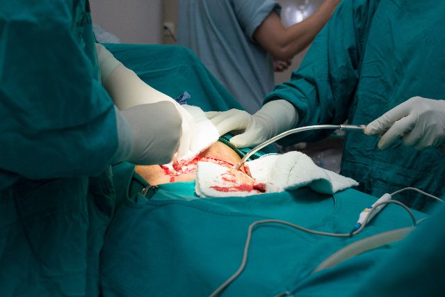 Turcja zakazuje cesarskich cięć bez wskazań medycznych